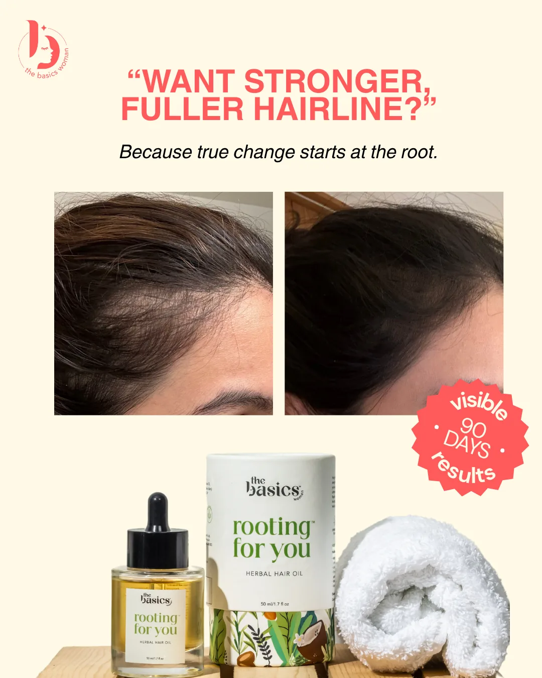 TBW — hairline static